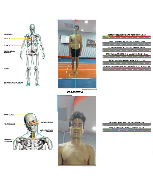 bikefitting motion capture