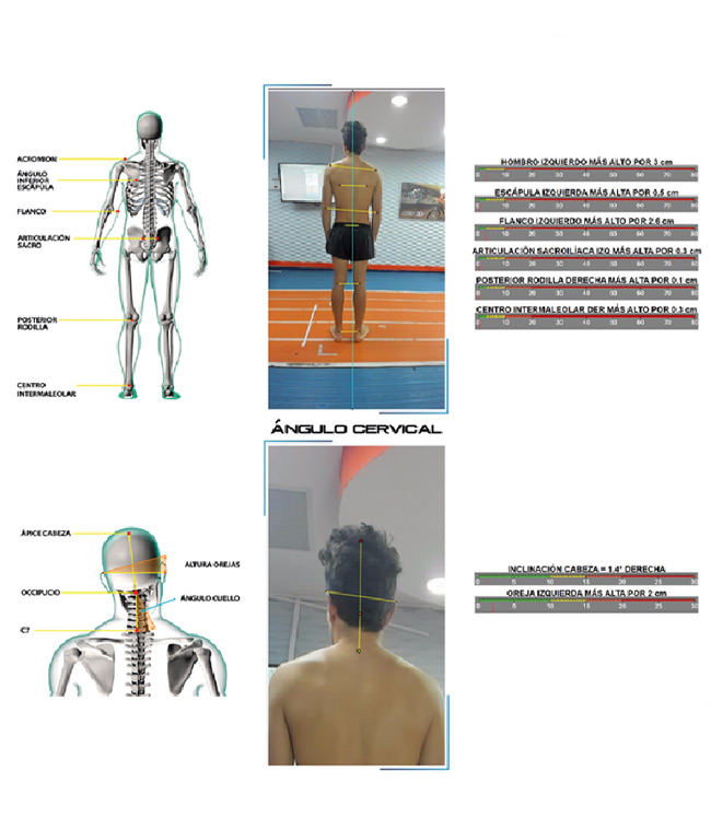 bikefitting motion capture