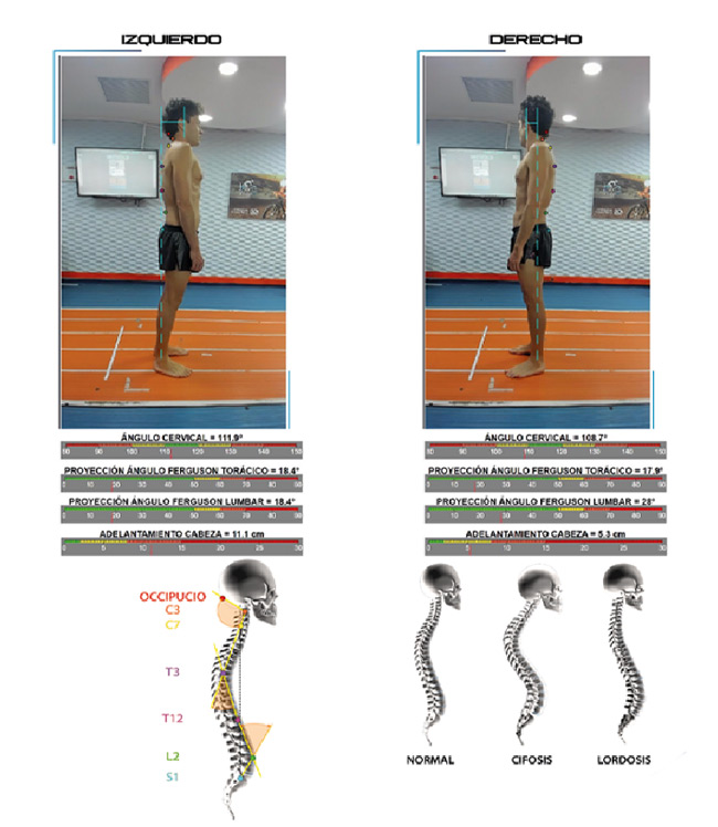 bikefitting motion capture