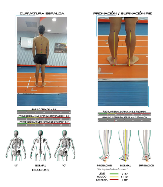 bikefitting motion capture