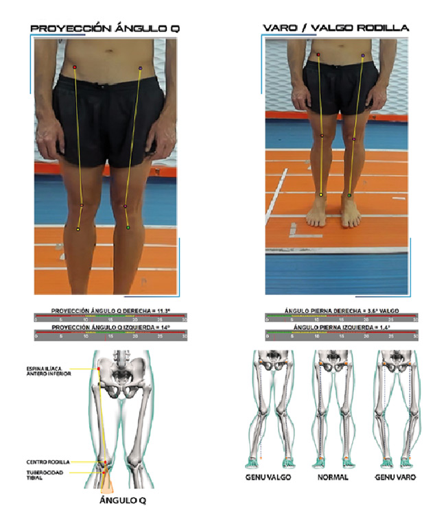 bikefitting motion capture